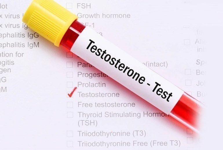 کمبود تستوسترون